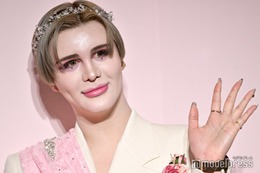 Matt、顎の異変告白 ヒアルロン酸は「顔に合計2L入ってるのかなっていう意識」 画像