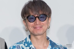 SUPER EIGHT安田章大、髄膜腫の手術後生活に変化 後遺症と向き合う日々とは「光の刺激をなるだけ少なくして」