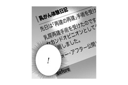 「再建の再建？」その手があったのか！自分の胸に希望が湧いてきた！【Dressing　美容外科医　森野まりあ #８】