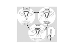 月経痛と過多月経の緩和に効果的なピル。10代でピルを服用するメリットは？【産婦人科医に聞く わたしとカラダの選択肢  #９】 画像