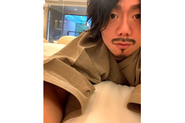 カマたく、人中短縮＆眉下切開の整形報告 ダウンタイム中の自撮りも公開「マジこいつ誰？」「顔が腫れてめちゃくちゃおもろい」