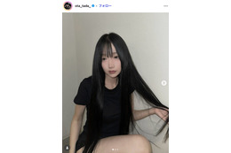 「月曜から夜ふかし」多田さん「残り10日で術後1ヶ月です」ノーマルカメラで整形DTの経過報告「強さに感動」「早く良くなりますように」と反響