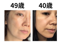 40代で肌年齢−14歳！ 美容医療なしで「40歳より透明感が出た」49歳美容ライターがリピ買いする美容成分TOP2 画像