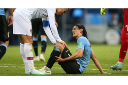 カバーニ、W杯準々決勝はどうなる…ウルグアイ代表が怪我について発表 画像