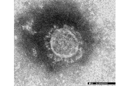 新型肺炎、3割が集団感染 画像