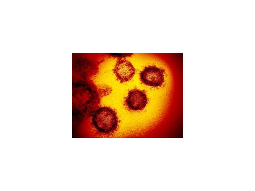 新型コロナウイルスの電子顕微鏡写真（米国立アレルギー感染症研究所提供）