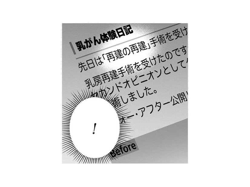 「再建の再建？」その手があったのか！自分の胸に希望が湧いてきた！【Dressing　美容外科医　森野まりあ #８】