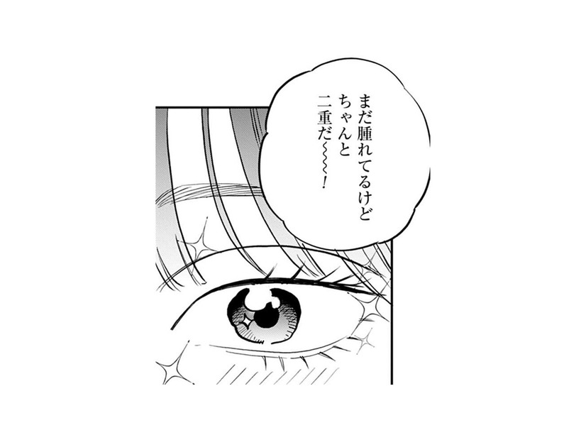 「本物だ！」ついにやった二重整形。アイテープとは違った感動を覚えて…【Dressing　美容外科医　森野まりあ #18】