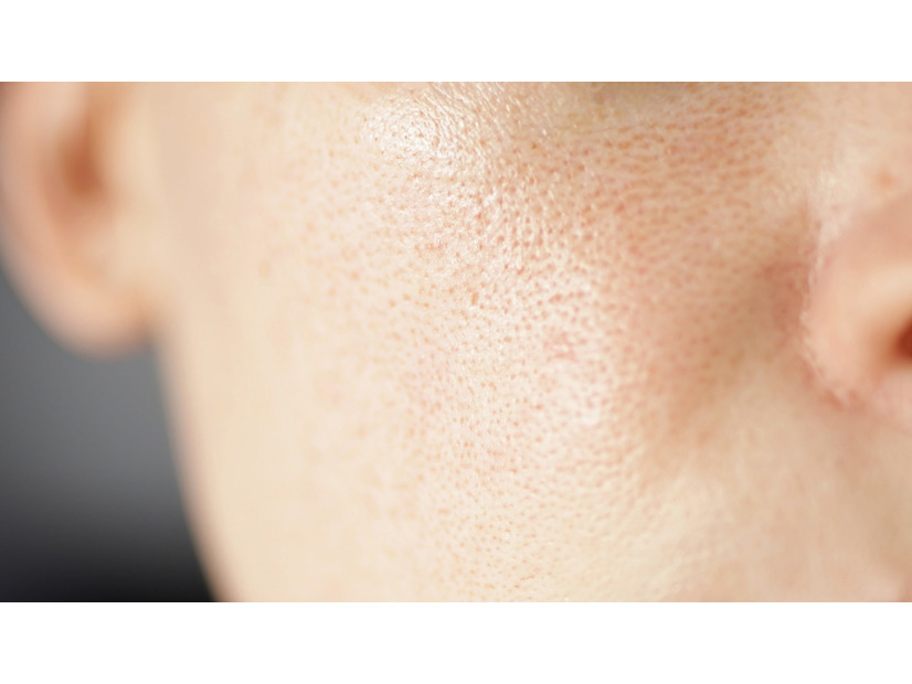 大人の毛穴問題にアプローチする「角栓崩壊洗浄技術」って？毛穴悩みの傾向と対策をシンプル解説。【大人の美容基礎知識】