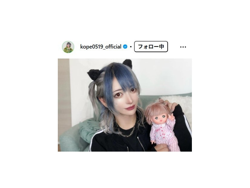 “全顔整形”リアルピース・こぺ「ダイエットが1番の整形」激変ビフォーアフター写真が話題「何キロ痩せたの？」「モチベーション上がる」