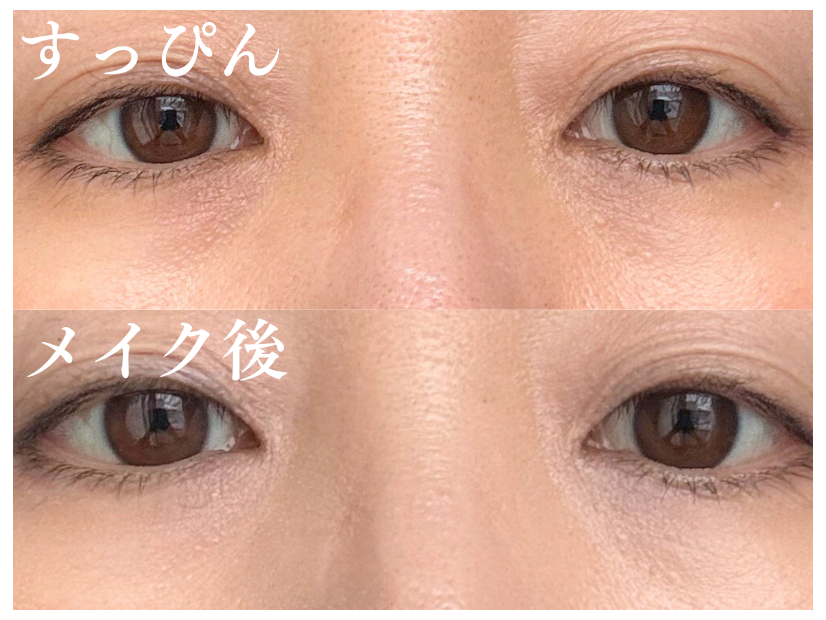 どんなに塗っても消えない。40代の黒クマがメイクでカバーできない理由