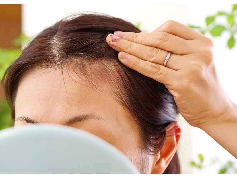 「抜け毛」が増えるのは、季節の変わり目のせい？ストレスのせい？「育毛鍼灸師が教える「異常信号」と、髪を生やすためにできること