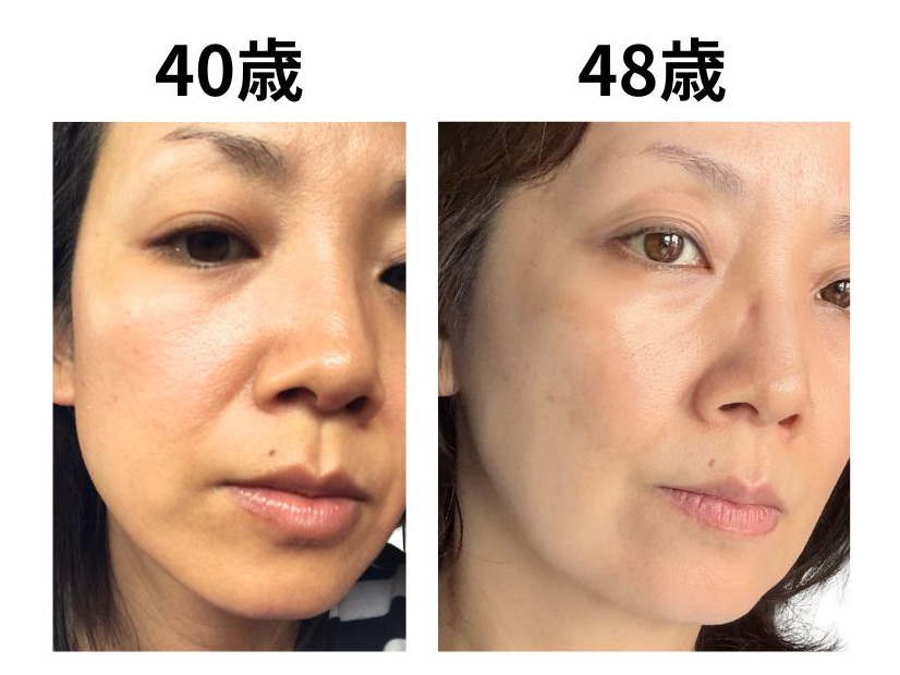 49歳で肌年齢−14歳。美容のプロが「5年愛用する美容成分」第3位と第2位
