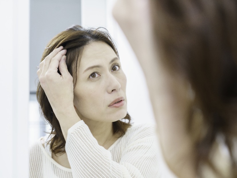 閉経後は「頭の中央の分け目」から薄毛が始まる⁉ 更年期の髪の悩み、原因を専門医が解説