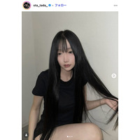 「月曜から夜ふかし」多田さん「残り10日で術後1ヶ月です」ノーマルカメラで整形DTの経過報告「強さに感動」「早く良くなりますように」と反響