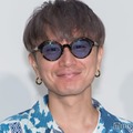 SUPER EIGHT安田章大、髄膜腫の手術後生活に変化 後遺症と向き合う日々とは「光の刺激をなるだけ少なくして」 画像