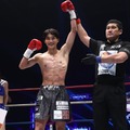 K-1大久保琉唯、金子晃大VS池田幸司をどう見る？自身は「とにかくK-1のベルトが欲しい」【モデルプレスインタビュー】 画像