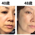 49歳で肌年齢−14歳。美容のプロが「5年愛用する美容成分」第3位と第2位 画像
