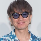 SUPER EIGHT安田章大、髄膜腫の手術後生活に変化 後遺症と向き合う日々とは「光の刺激をなるだけ少なくして」 画像