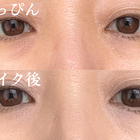 どんなに塗っても消えない。40代の黒クマがメイクでカバーできない理由 画像