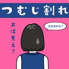 後頭部の髪がパックリ割れる「つむじ問題」、一体どうすればいいの？ 画像