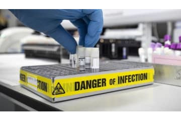 柏で新型コロナ感染者多数…ルヴァンカップ決勝が延期に 画像