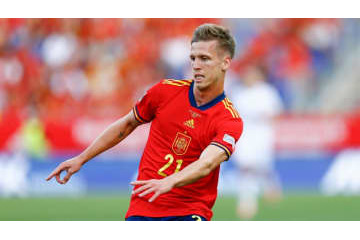 スペイン代表MF、美容院で強盗が待ち伏せ…430万円のロレックスを奪われ負傷 画像