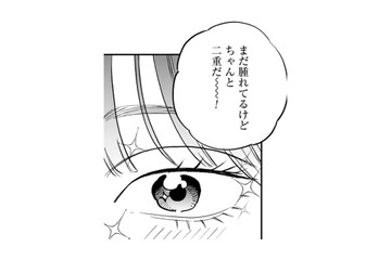 「本物だ！」ついにやった二重整形。アイテープとは違った感動を覚えて…【Dressing　美容外科医　森野まりあ #18】 画像