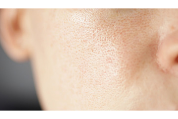 大人の毛穴問題にアプローチする「角栓崩壊洗浄技術」って？毛穴悩みの傾向と対策をシンプル解説。【大人の美容基礎知識】 画像