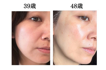 頭や首、肩のコリも老け肌につながっていた。肌年齢マイナス14歳美容のプロがやめたこととは？ 画像