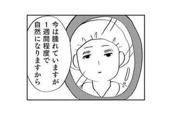 「整形しないと幸せになれない」中学卒業後、母の勧めで二重整形をすることに【親に整形させられた私が母になる #１】 画像