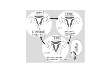 月経痛と過多月経の緩和に効果的なピル。10代でピルを服用するメリットは？【産婦人科医に聞く わたしとカラダの選択肢  #９】 画像