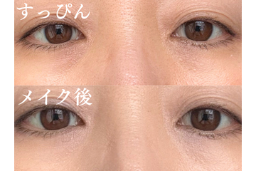 どんなに塗っても消えない。40代の黒クマがメイクでカバーできない理由 画像