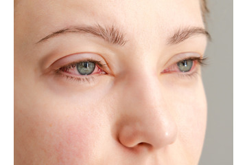 「目のかゆみ」がつらすぎる…その花粉症、実は“肝の疲れ”かも？漢方の専門家がおすすめする「酸味」と「苦味」の食べ物 画像