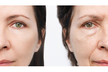 「老化は自然現象ではなく、コントロールできる病気」。老化抑制する成分がブロッコリーの７倍もある野菜とは 画像