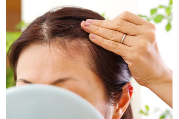 「抜け毛」が増えるのは、季節の変わり目のせい？ストレスのせい？「育毛鍼灸師が教える「異常信号」と、髪を生やすためにできること 画像