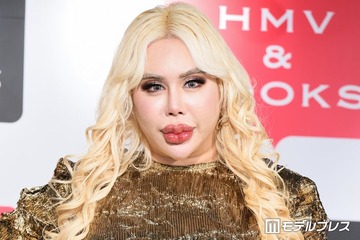 “整形総額1億円超え”アレン様、月の美容費は「140〜150万円」唇ヒアルロン酸注射事情もぶっちゃけ「針穴から漏れ出るくらい…」 画像