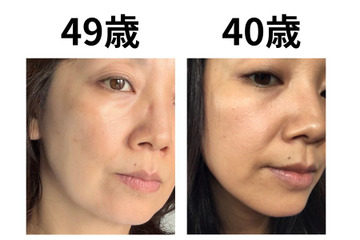 40代で肌年齢−14歳！ 美容医療なしで「40歳より透明感が出た」49歳美容ライターがリピ買いする美容成分TOP2 画像