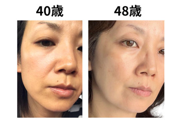 49歳で肌年齢−14歳。美容のプロが「5年愛用する美容成分」第3位と第2位 画像