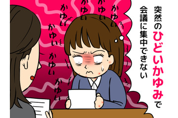 蕁麻疹も更年期のサイン⁉突然襲ってきた「かゆみ地獄」の原因と対処法 画像