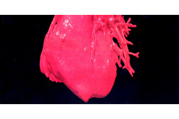 18歳で突然死した選手、「検出不能」な心臓の奇形があった？ 画像