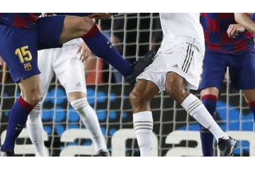 ヴァラン、痛々しい「ラングレに蹴られた傷」がこれ 画像