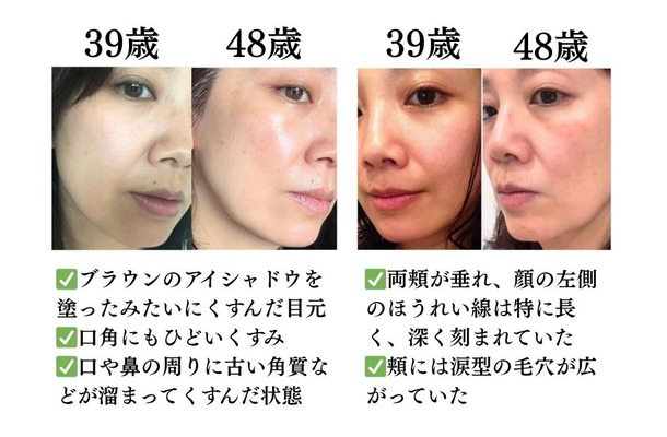 「ほうれい線の原因が判明!」やめたら「巻き戻し美容」が進んだ。40代からの「老け見え」を防ぐ生活習慣とは?