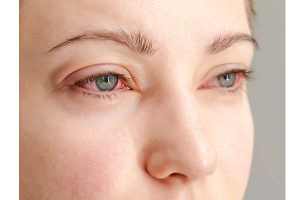 「目のかゆみ」がつらすぎる…その花粉症、実は“肝の疲れ”かも?漢方の専門家がおすすめする「酸味」と「苦味」の食べ物