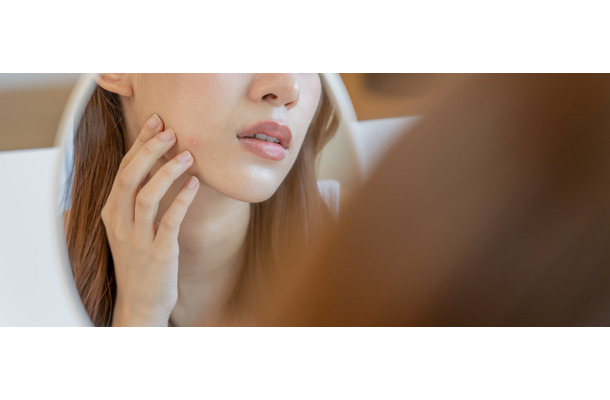 しっとりすっぴん肌が花粉肌荒れのトリガーかも！ゆらぐ肌を守るベースメイクの極意