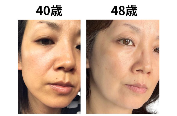 49歳で肌年齢−14歳。美容のプロが「5年愛用する美容成分」第3位と第2位