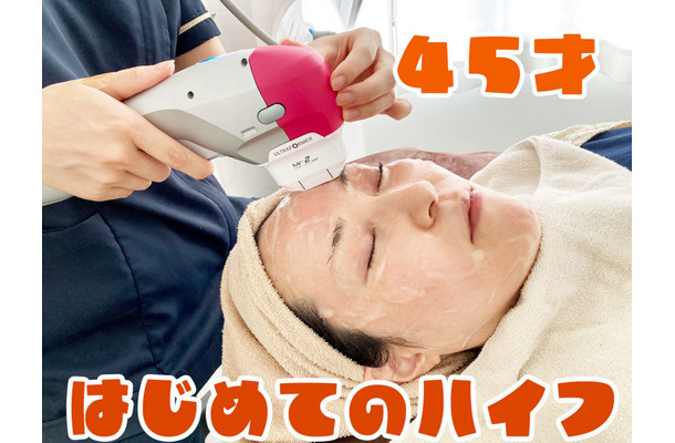 【美容】45歳、はじめてのハイフ。たるんだ顔はどれだけ変わるのか!?