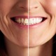 「歯ぐきの老化でオバサン化が加速」。「エストロゲンが減少」する更年期女性ほど歯ぐきケアが大事な理由とは【専門家が解説】