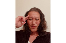 元光GENJI大沢樹生、人生初の交通事故＆1週間後に自転車で転倒 痛々しい傷跡残る近影公開