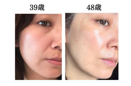 頭や首、肩のコリも老け肌につながっていた。肌年齢マイナス14歳美容のプロがやめたこととは？